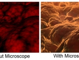 Bacteria